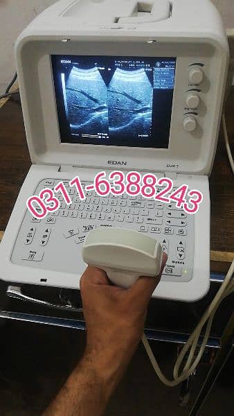 Ultrasound machine 15