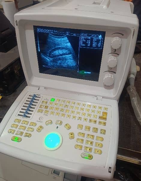 Ultrasound machines 11