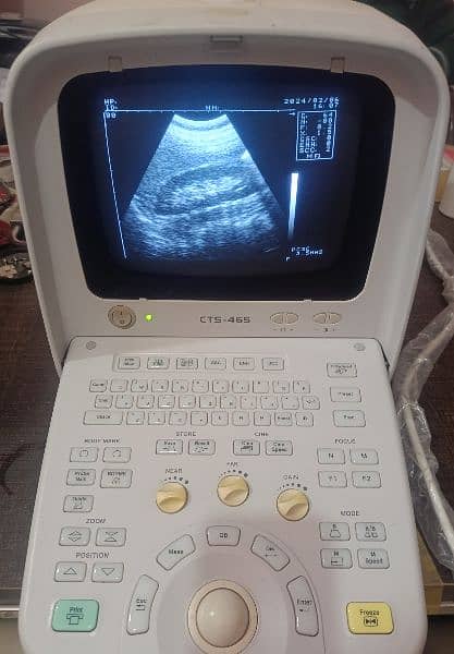 Ultrasound machines 19