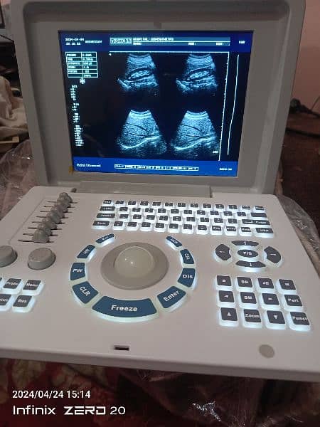 Ultrasound machines 2