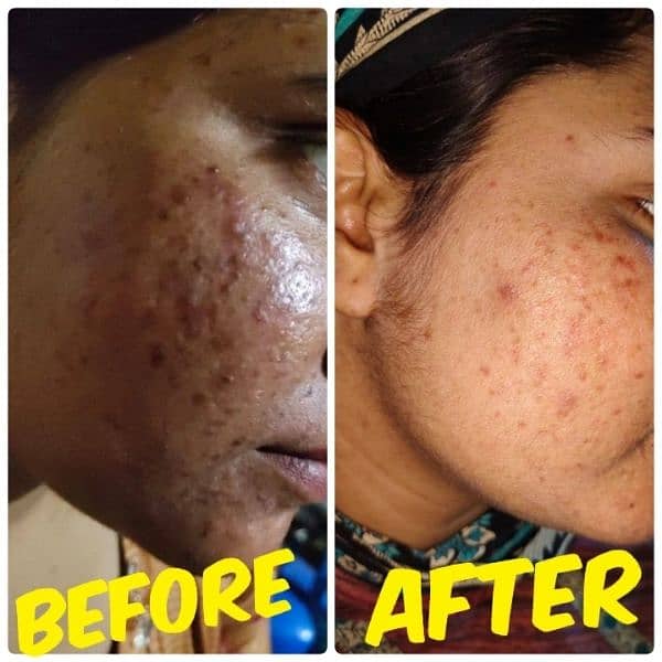 skin treatment 19