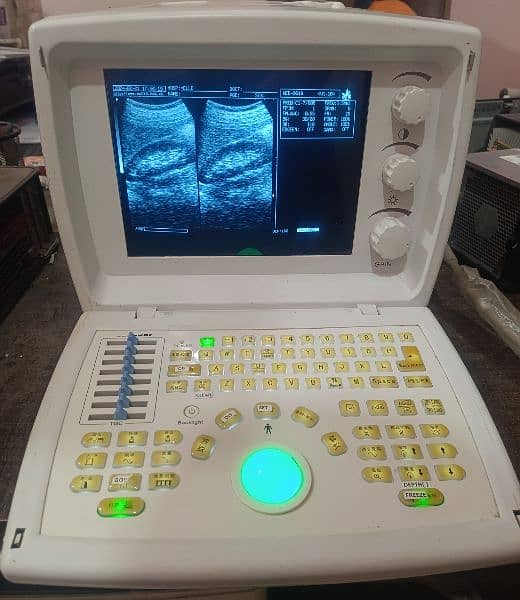 Ultrasound machines 18
