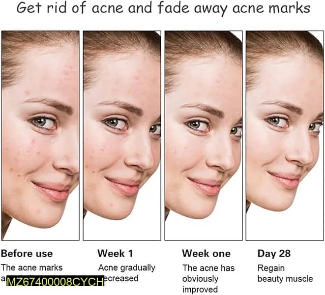 Anti-Acne Facial Serum Aloe Vera Extract Salicylic Acid Repairs 2