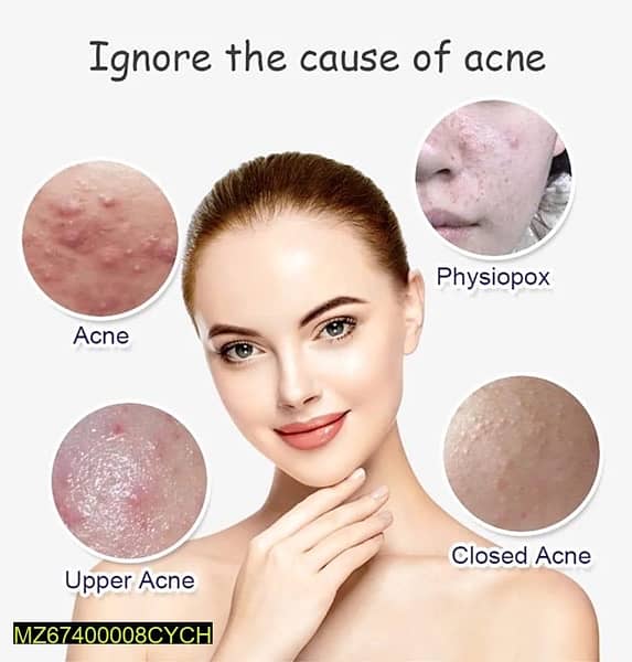 Anti-Acne Facial Serum Aloe Vera Extract Salicylic Acid Repairs 3