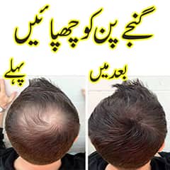 Toppik hair fiber price in pakistan toppik hair fiber pakistan toppik 0