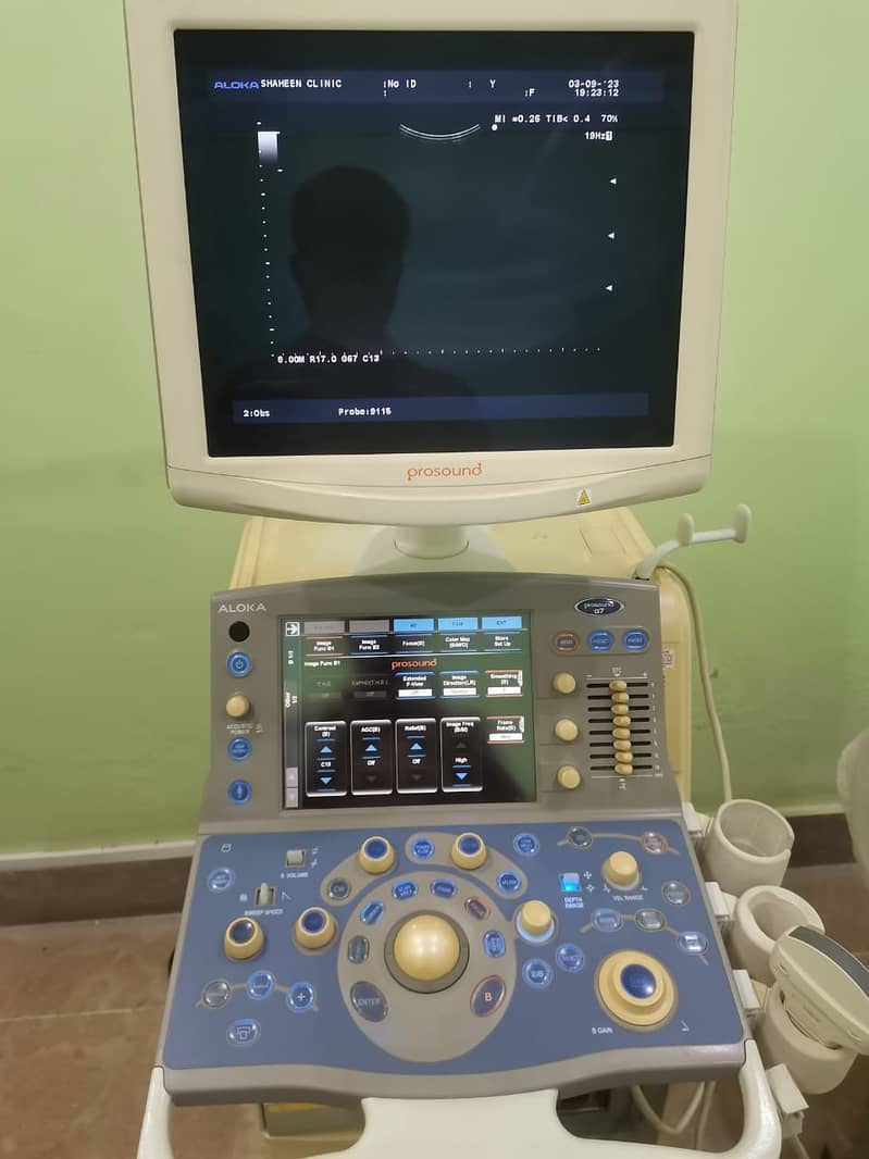 Colour Dopler Aloka Prosound Ultrasound Machine 3