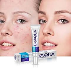 Bioaqua acne removal cream