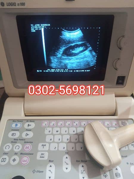 Aloka 1200 Ultrasound Machine available, Contact; 0302-5698121 9