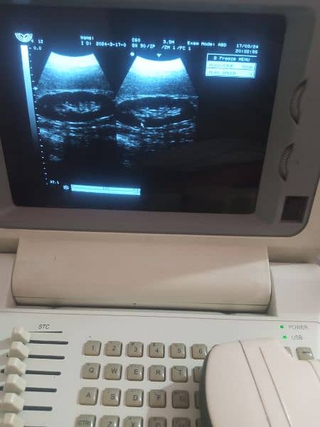 portable ultrasound machine for sale, Contact; 0302-5698121 1