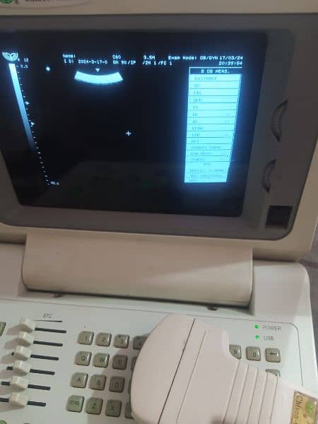 portable ultrasound machine for sale, Contact; 0302-5698121 8