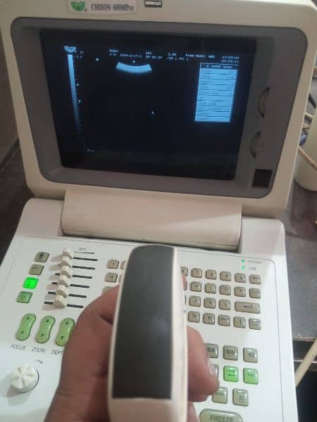portable ultrasound machine available in stock 5