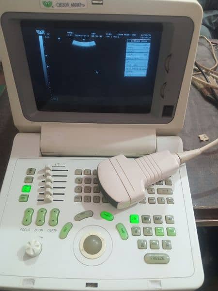portable ultrasound machine available in stock 9