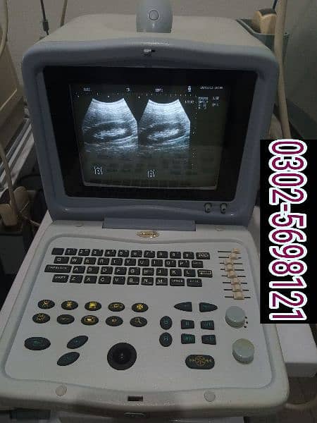 japanese ultrasound machine For sale, Contact; 0302-5698121 11