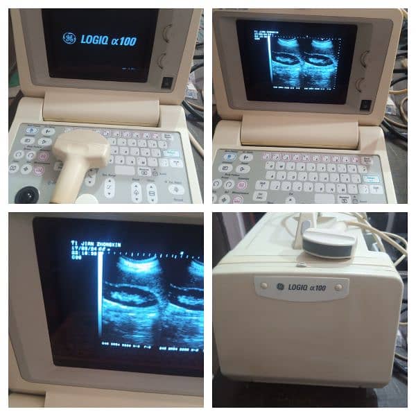 japanese ultrasound machine For sale, Contact; 0302-5698121 13