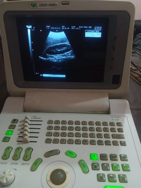 Aloka ultrasound machine for sale, Contact; 0302-5698121 5