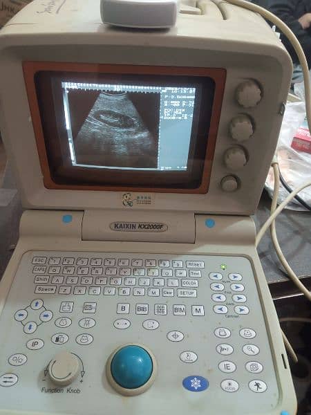 portable ultrasound machine for sale, Contact; 0302-5698121 2