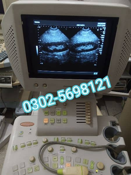 Refurbished ultrasound machine available in stock 3