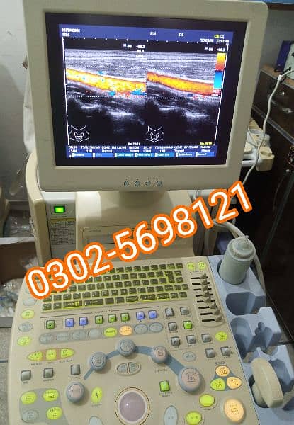 portable ultrasound machine available in stock 12