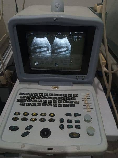 portable ultrasound machine available in stock 14