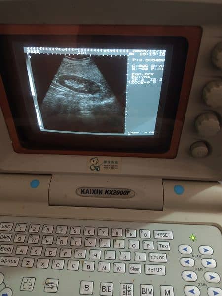 portable ultrasound machine available in stock 17