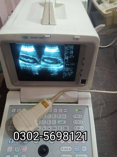 portable ultrasound machine for sale, Contact; 0302-5698121 12