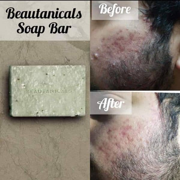 Whiting And Any skin problem 1 solution soap 4