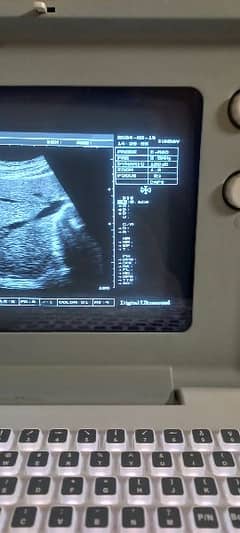 ultrasound machine latest model. . .