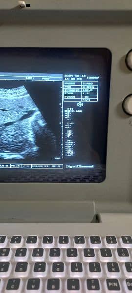 ultrasound machine latest model. . . 0