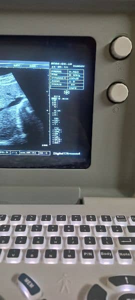 ultrasound machine latest model. . . 1