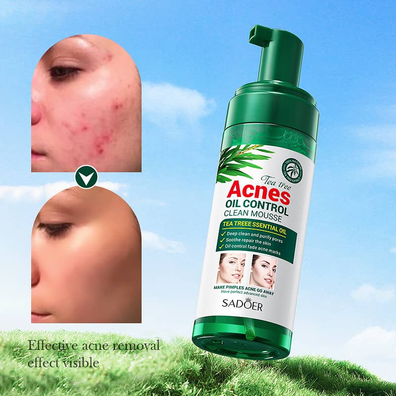 Sadoer Tea Tree Acnes Oil Control , Acne Control  Product , Skincare 3