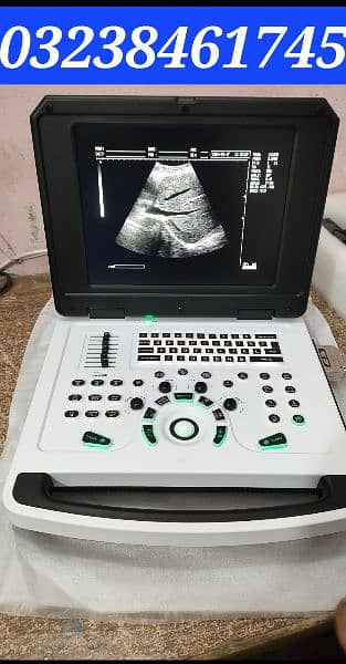 brand new china Novadex N12 portable ultrasound machine 0