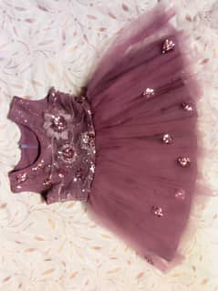 Baby frock