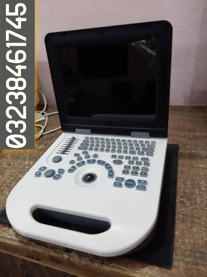 new china nyro 10 portable ultrasound machine with battery backup 0