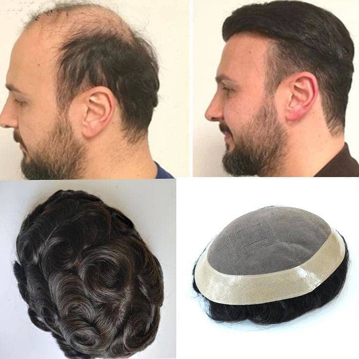 Men wig imported quality hair patch _hair unit(0'3'0'6'4'2'3'9'1'0'1) 7