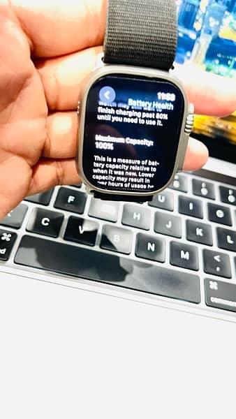 Apple watch Ultra 1 5