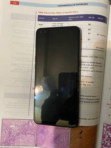 Oppo f17 pro just like new with box 2