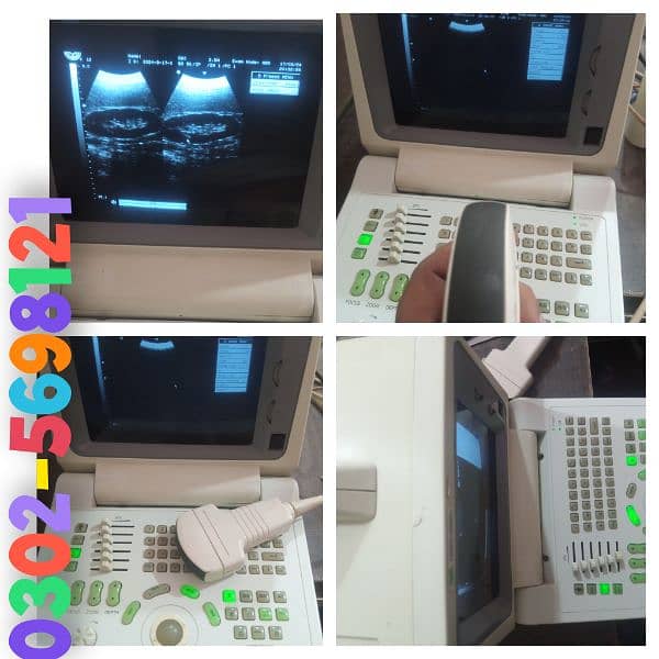 portable ultrasound machine for sale, Contact; 0302-5698121 0