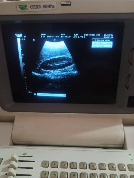 portable ultrasound machine for sale, Contact; 0302-5698121 3