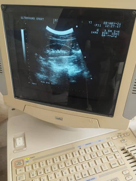 aloka 1400 ultrasound machine 0