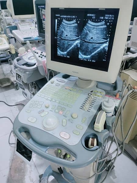 Toshiba Ultrasound Machine Japani available in ready stock 0