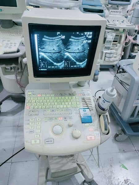 Aloka (Japan) Ultrasound Machine available in ready stock 2