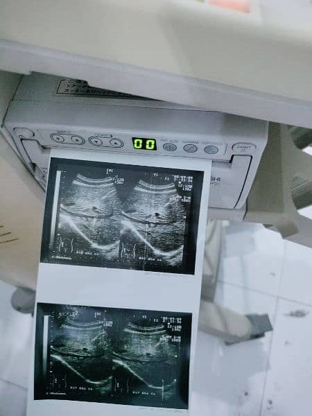 Aloka (Japan) Ultrasound Machine available in ready stock 3