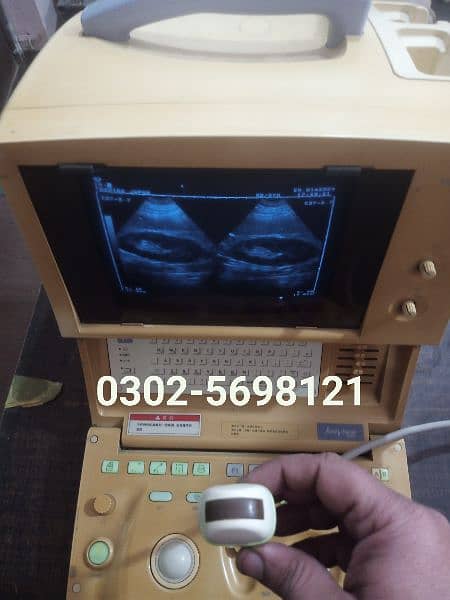 Toshiba, Aloka, Ultrasound Machine for sale, Contact; 0302-5698121 18