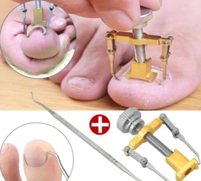 Nail print|Nail stamper|Nail art|ingrown nails|tool|nail treatment|Nai 1