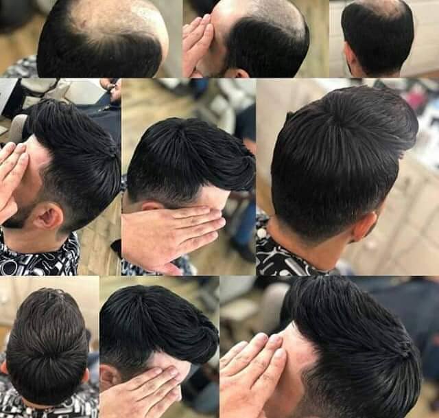 Men wig imported quality hair patch _hair unit(0'3'0'6'4'2'3'9'1'0'1) 1