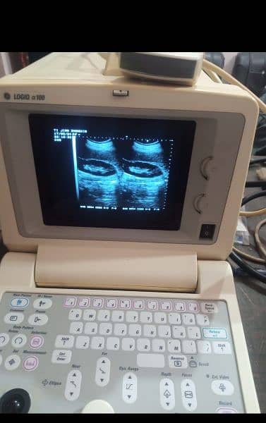 ultrasound machine latest model. . . 5