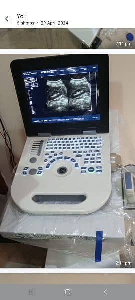ultrasound machine latest model 7