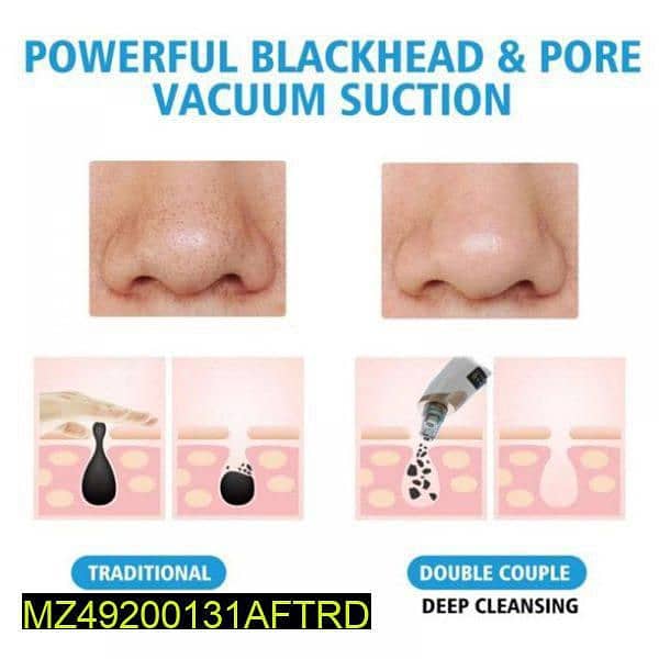 Imported Blackheads pore cleaner 2
