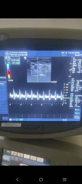 logiq 9 colour Doppler with convex and linear probes 1