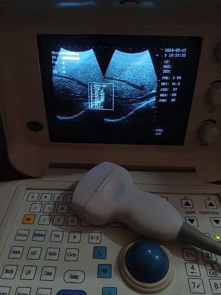 portable ultrasound machine avaiblae, Contact; 0302-5698121 2